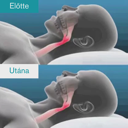LUXANA™ - Horkolásgátló